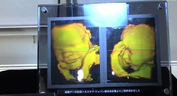 En Japón ya pueden imprimir un holograma 3D de un bebé por nacer.