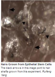 Hacen crecer pelo a partir de células madre, por primera vez