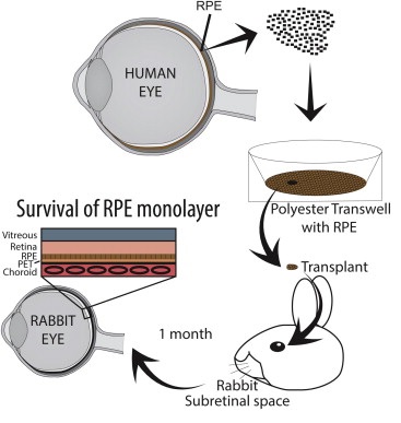 Células madre para recobrar la vista en casos de degeneración macular