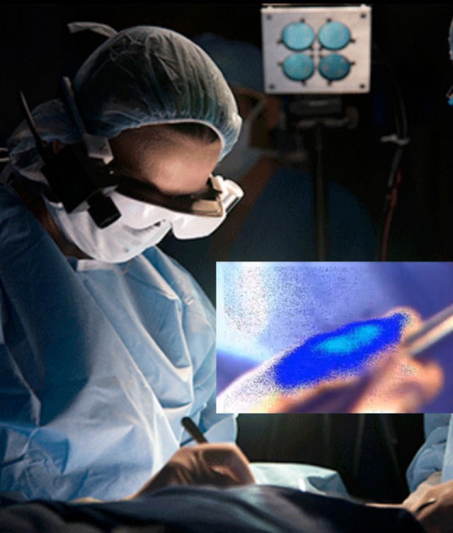 Inventan gafas inteligentes que permiten ver celulas cancerosas