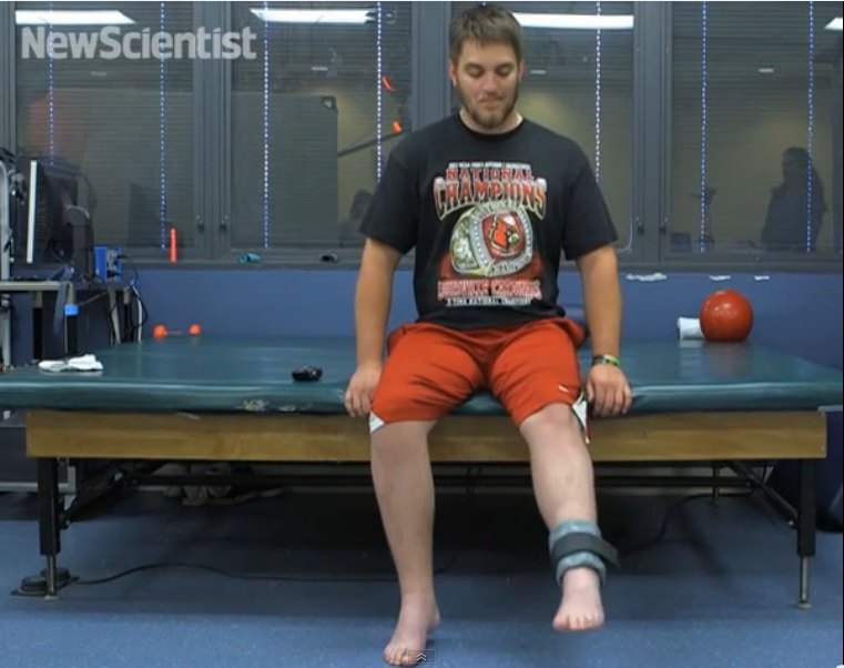 Implante en médula espinal revive piernas de paciente paralizado