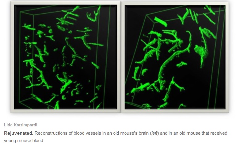 Científicos revierten envejecimiento en ratones dándoles sangre joven