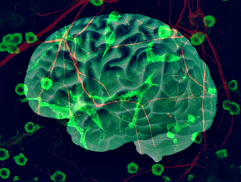 Demasiadas conexiones neuronales podría ser una causa del autismo