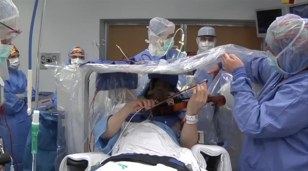 Paciente toca violín durante cirugía a su cerebro