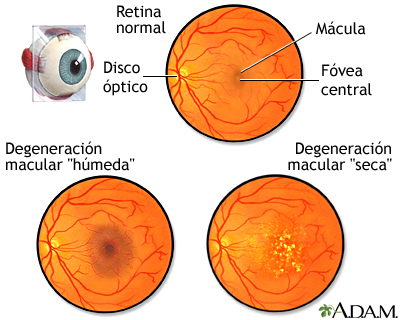 Nuevo medicamento contra la degeneración macular asociada a la edad