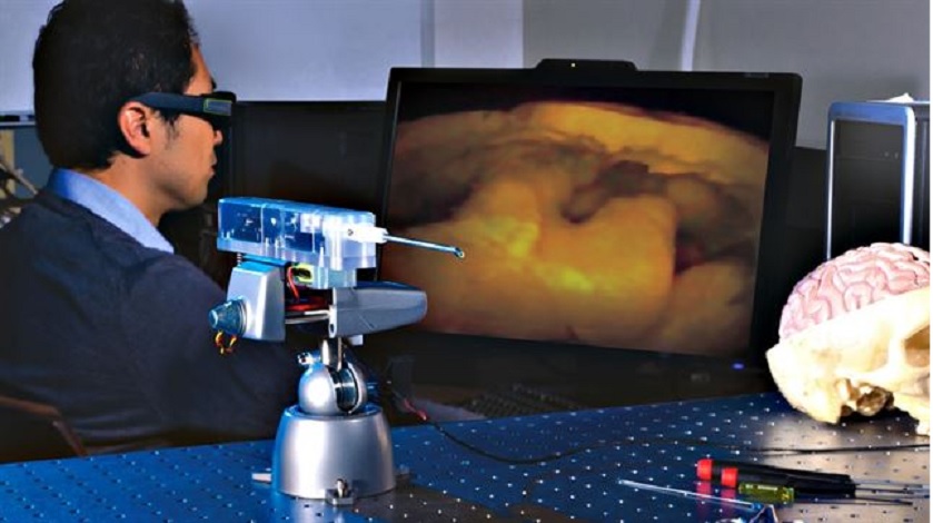Fabrican cámara 3D tan pequeña que permite operar en el cerebro
