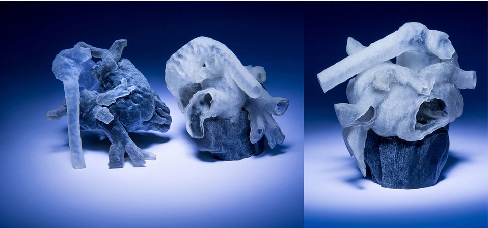 Cirujanos imprimen en 3D modelos del corazón de los pacientes