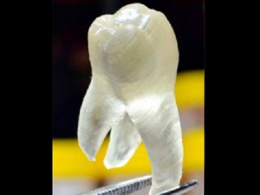 No más caries usando dientes impresos en 3D