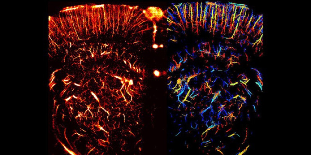 Burbujas diminutas mejoran notablemente las imágenes de los vasos sanguíneos
