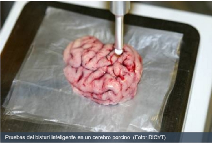 Diseñan un bisturí inteligente que localiza tumores cancerígenos en el cerebro
