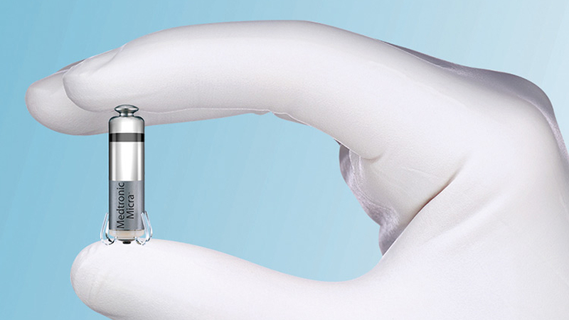 El marcapasos más pequeño del mundo se puede implantar sin cirugía