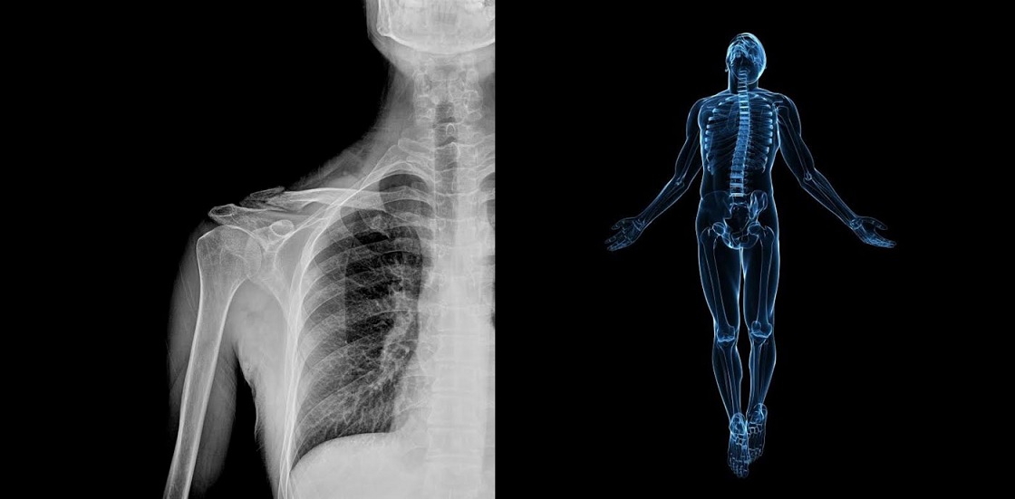 Médicos de Inteligencia Artificial diagnosticarán sus radiografías