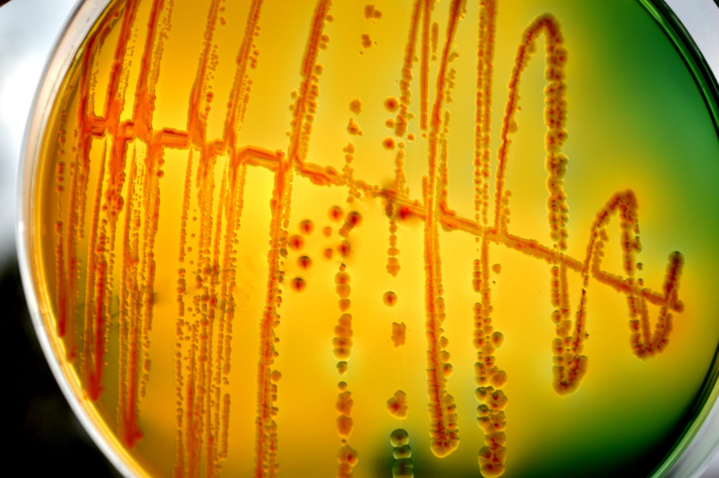 Nanoflores pueden detectar bacterias antes de que se enferme
