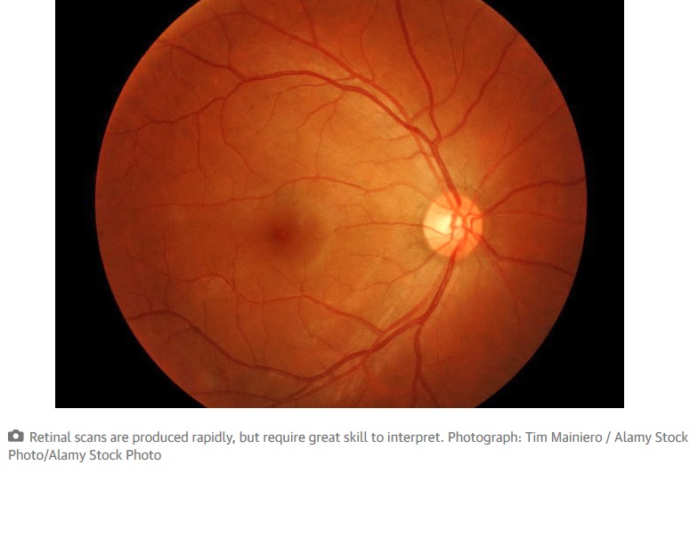 Google DeepMind detectará enfermedades de los ojos con Inteligencia Artificial
