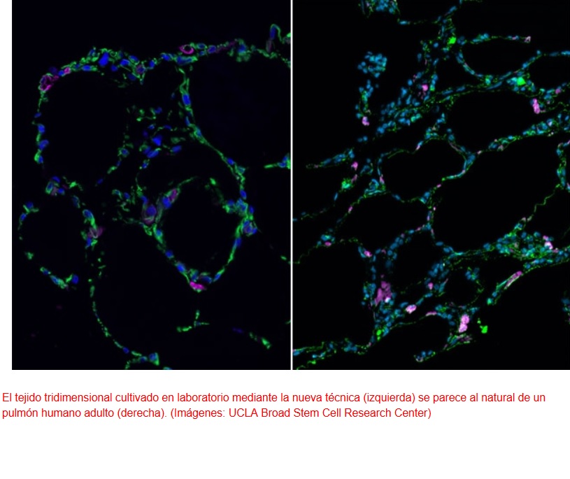 Células madre para cultivar estructuras 3D pulmonares fuera del cuerpo