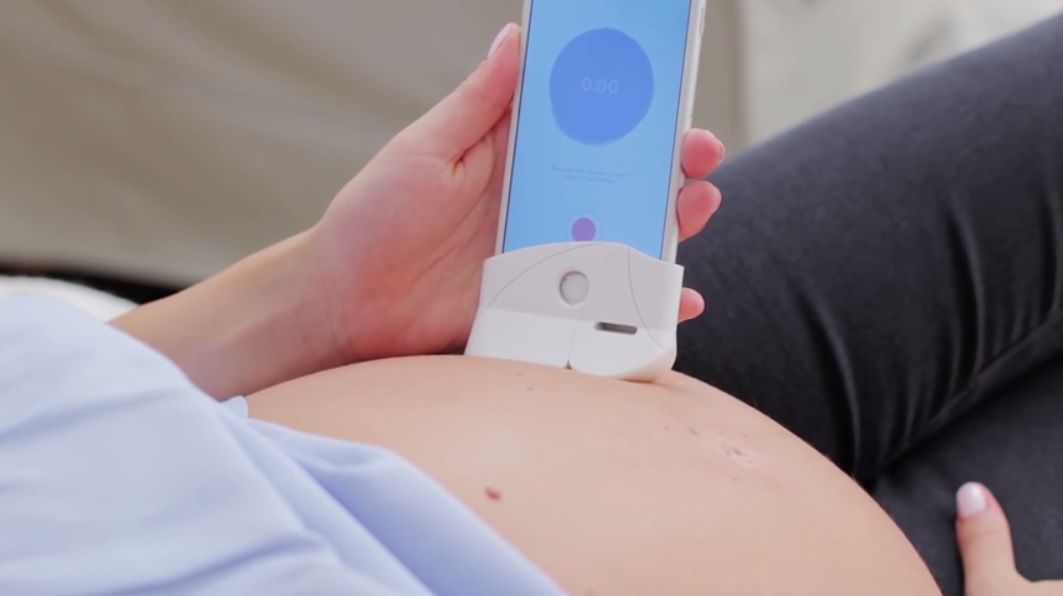 Accesorio para iPhone permite escuchar el latido del corazón de su bebé