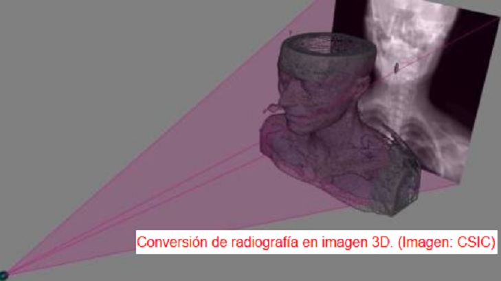Un nuevo dispositivo obtiene imágenes en 3D a partir de radiografías