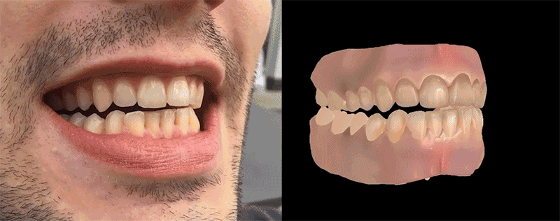 Investigadores crean prótesis dentales perfectas usando sólo un video de sus dientes