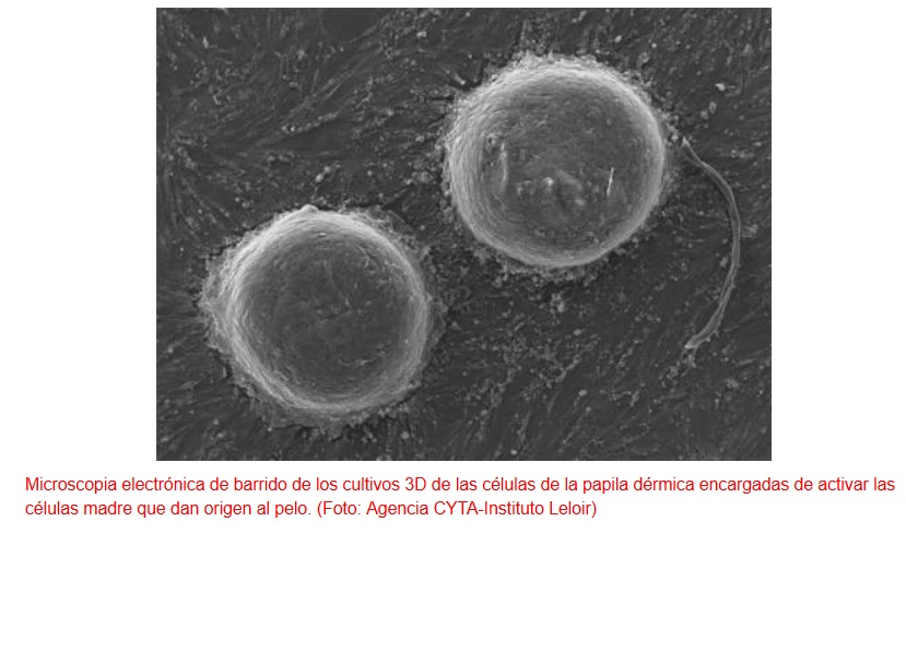 Proponen activar células madre para tratar la calvicie