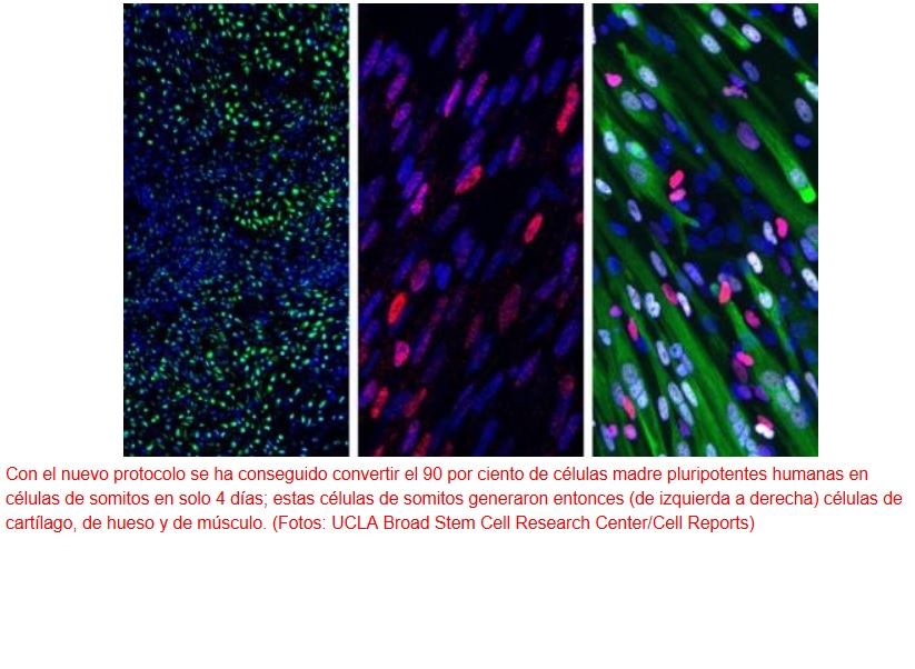 Logran convertir células madre en precursores de hueso, cartílago y músculo esquelético