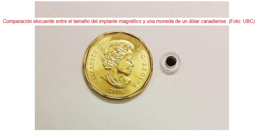 Diminuto implante magnético para suministro intracorporal ultrapreciso de medicamentos