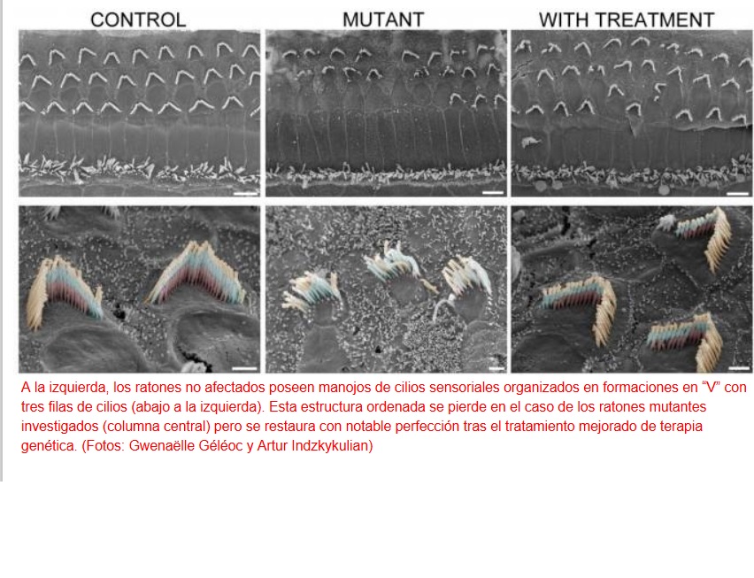 Restauran una buena sensibilidad auditiva en ratones mediante terapia genética