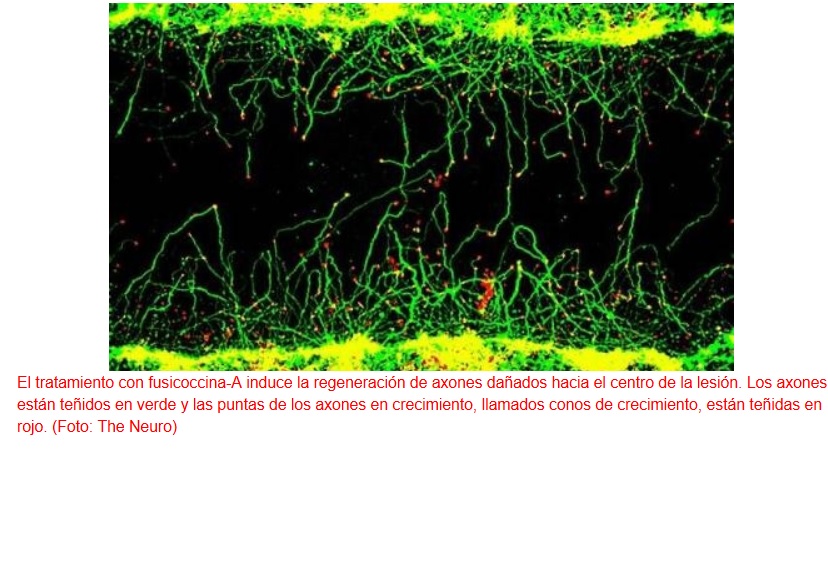 Sustancia capaz de reparar axones dañados de neuronas