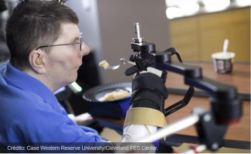 Un hombre tetrapléjico recupera la movilidad de su brazo gracias a un implante en su cerebro