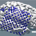 Investigación demuestra que la estimulación eléctrica al cerebro puede ayudar a la memoria