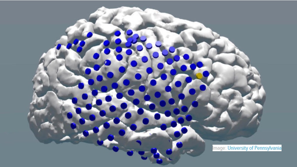 Investigación demuestra que la estimulación eléctrica al cerebro puede ayudar a la memoria