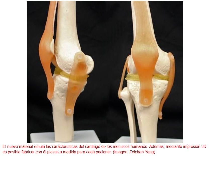 Implantes para rodillas dañadas fabricados por impresión 3D