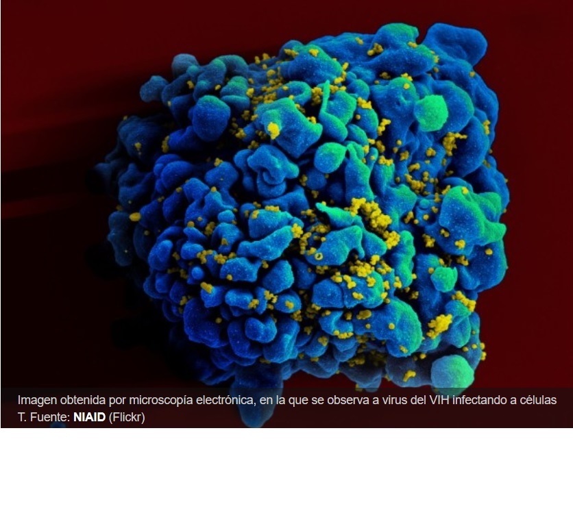 Consiguen eliminar el VIH de animales y células humanas gracias a la edición genética