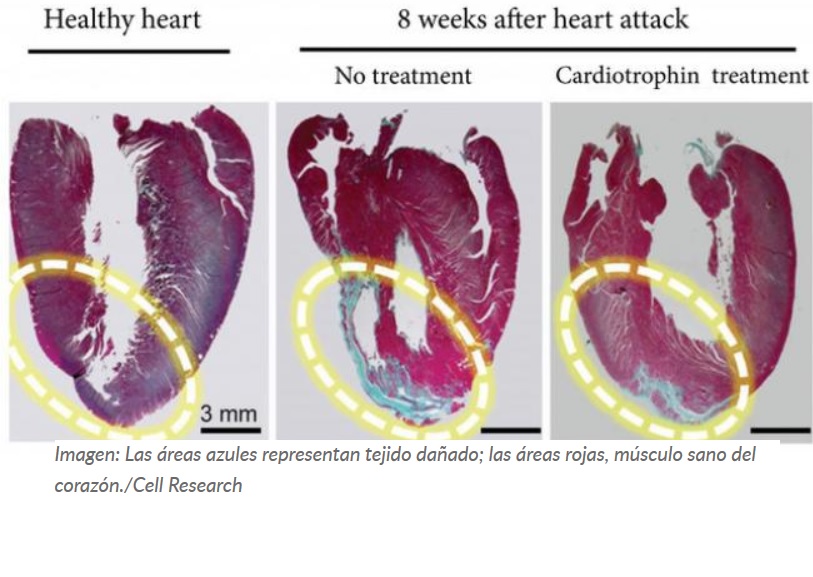 Descubren una proteína que ‘engaña’ al corazón para que crea que haces ejercicio