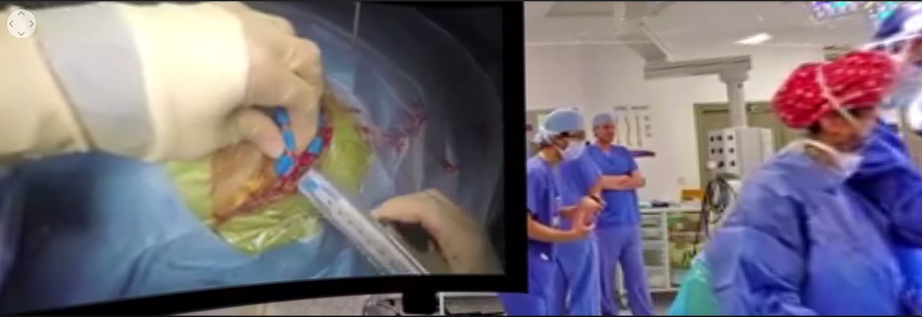 Ahora puede ver la primera cirugía de 360 ​​VR en el cerebro