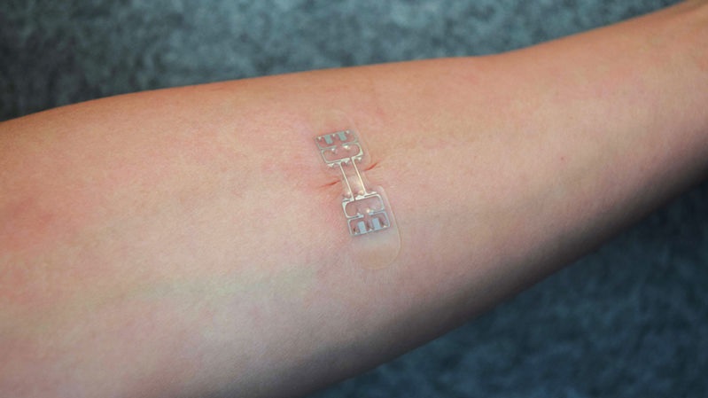 Dispositivo parecido a un vendaje podría hacer que los puntos de sutura y grapas sean cosa del pasado
