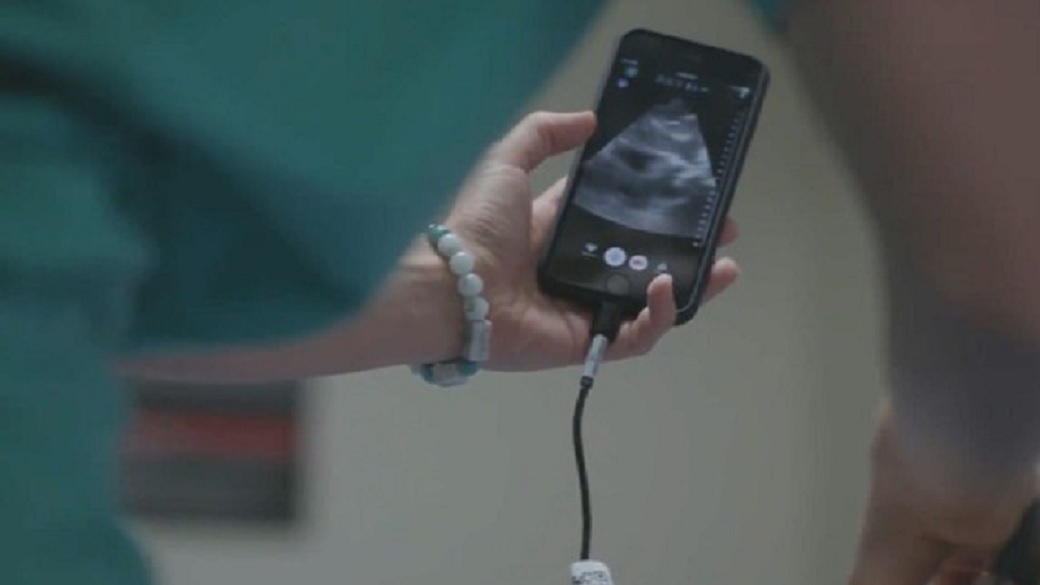 Dispositivo de ultrasonido para smartphone ayuda a médico a diagnosticar su propio cáncer