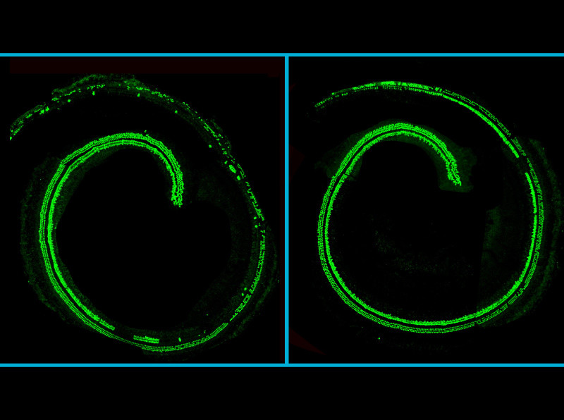 Atacando la sordera congénita: CRISPR consigue frenar la degeneración del oído en ratones vivos