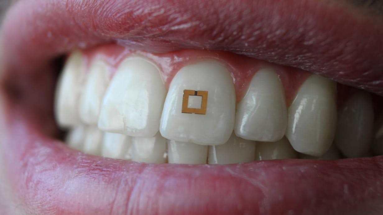 Diminuto sensor montado en el diente rastrea lo que come