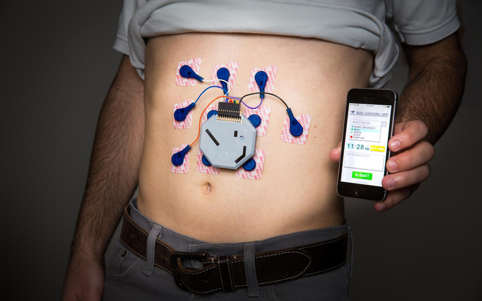 Monitor para el estómago podría reemplazar la necesidad de sondas invasivas