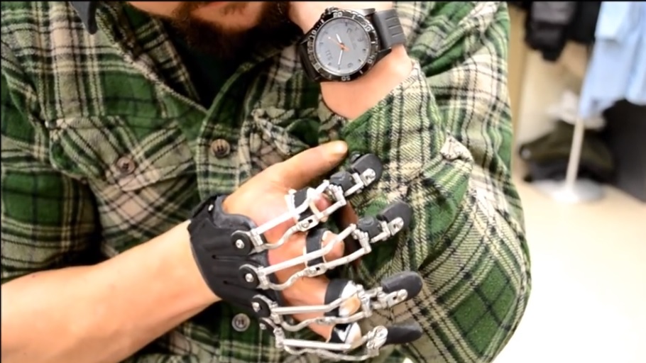 Fabrican prótesis personalizadas que funcionan con los movimientos naturales de la mano del usuario
