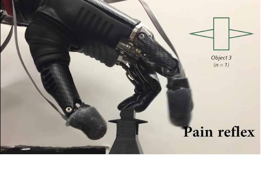 'Piel electrónica' permite al usuario de una mano protésica sentir dolor