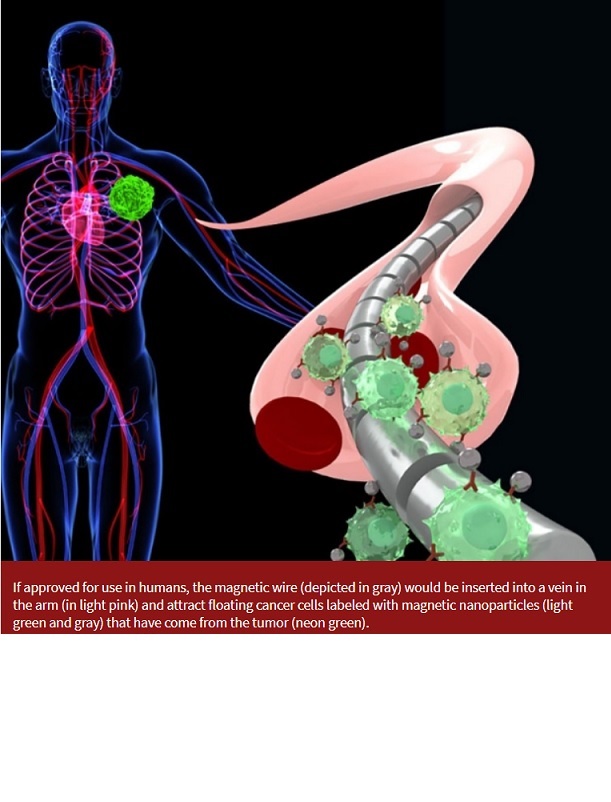 Cable especial magnetizado podría usarse para detectar células cancerosas flotando en la sangre