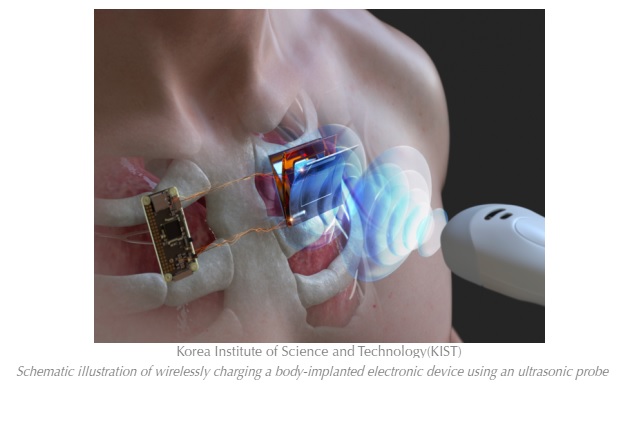 Tecnología inalámbrica para cargar dispositivos electrónicos implantados en el cuerpo y bajo el agua