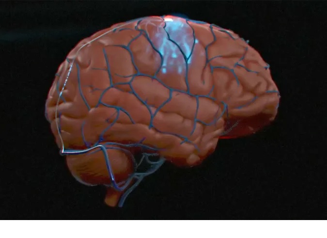 Logran implantar una interfaz cerebro-computadora humana en un paciente en USA
