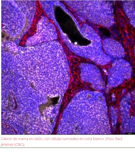 Nanopartículas mejoran inmunoterapias contra el cáncer