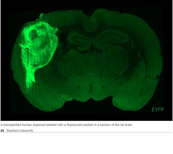 Trasplantan neuronas humanas a cerebros de ratones