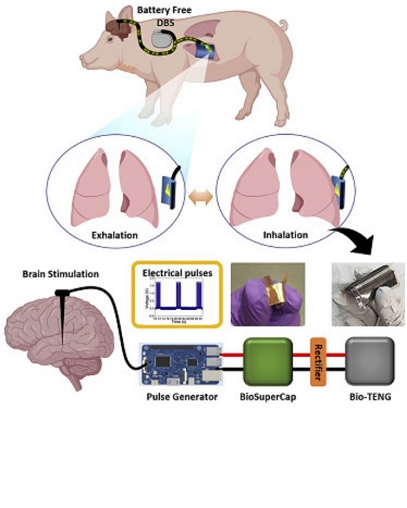 Construyen implante cerebral impulsado por la respiración del usuario