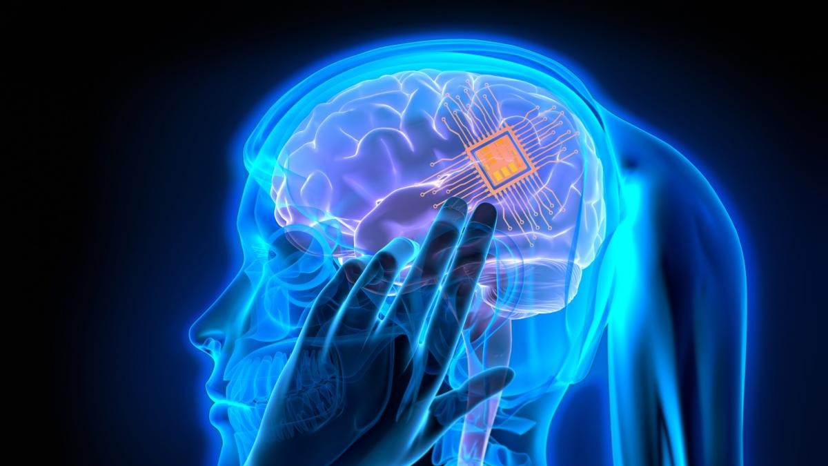 Primer implante cerebral para tratar la depresión
