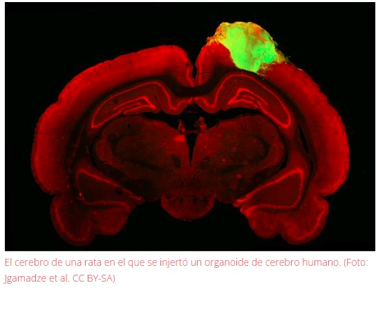 Insertan neuronas humanas en cerebros de ratas para reemplazar la funcionalidad de la visión dañada