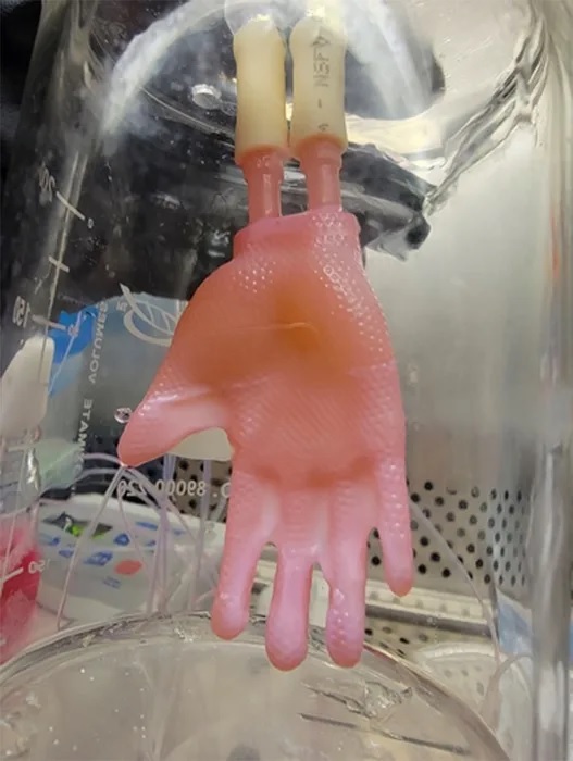 Bioimprimen injertos de piel 3D sin costuras para pacientes quemados
